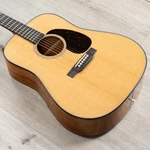Mint Martin Cs D-28 Dreadnought Acous. Gtr. Flamed Koa, Vts Sitka Spruce Top. Fixed Price $5902.49.